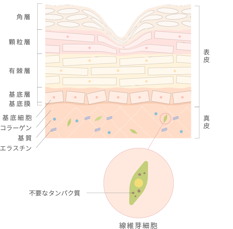 炎症が進む肌の構造図